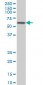 CACNB2 Antibody (monoclonal) (M01)