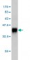 CACNB2 Antibody (monoclonal) (M05)