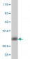 CALCA Antibody (monoclonal) (M01)
