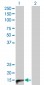 CALCA Antibody (monoclonal) (M01)