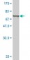 CALR Antibody (monoclonal) (M01)