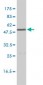 CALR Antibody (monoclonal) (M01)