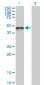CALR Antibody (monoclonal) (M01)