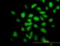 CAMK2A Antibody (monoclonal) (M01)