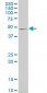 CAMK2A Antibody (monoclonal) (M01)