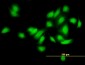 CAMK2A Antibody (monoclonal) (M03)