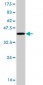 CAMK2A Antibody (monoclonal) (M03)