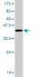 CAMK2A Antibody (monoclonal) (M03)