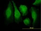 CAMK2B Antibody (monoclonal) (M06)