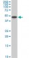 CAMK2B Antibody (monoclonal) (M06)