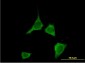 CAMK2D Antibody (monoclonal) (M02)