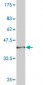 CAMK2D Antibody (monoclonal) (M02)