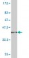 CAMK2D Antibody (monoclonal) (M02)