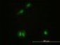 CAMK4 Antibody (monoclonal) (M01)