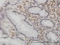 CAMKK1 Antibody (monoclonal) (M01)