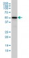 CAMKK1 Antibody (monoclonal) (M01)
