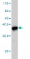 CANT1 Antibody (monoclonal) (M01)