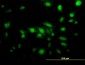 CAPG Antibody (monoclonal) (M01)