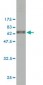 CAPG Antibody (monoclonal) (M01)