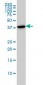CAPG Antibody (monoclonal) (M01)