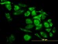 CAPG Antibody (monoclonal) (M02)