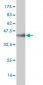 CAPG Antibody (monoclonal) (M02)