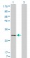 CAPNS1 Antibody (monoclonal) (M01)