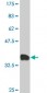 CAPZB Antibody (monoclonal) (M02)