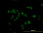 CARF Antibody (monoclonal) (M02)