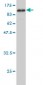 CARF Antibody (monoclonal) (M02)