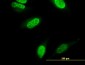 CARF Antibody (monoclonal) (M04)