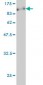 CARF Antibody (monoclonal) (M04)