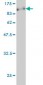 CARF Antibody (monoclonal) (M04)