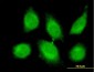 CBLL1 Antibody (monoclonal) (M01)