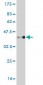 CBX2 Antibody (monoclonal) (M04)