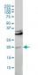 CBX5 Antibody (monoclonal) (M01)