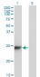 CBX5 Antibody (monoclonal) (M01)