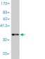 CCL11 Antibody (monoclonal) (M01)