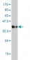 CCL7 Antibody (monoclonal) (M03)
