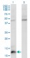 CCL7 Antibody (monoclonal) (M03)