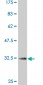 CCR2 Antibody (monoclonal) (M01A)