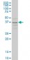 CCR2 Antibody (monoclonal) (M01A)