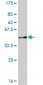 CCT2 Antibody (monoclonal) (M01)