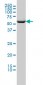 CCT2 Antibody (monoclonal) (M01)