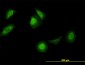 CCT5 Antibody (monoclonal) (M01)