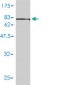 CCT5 Antibody (monoclonal) (M01)