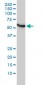 CCT5 Antibody (monoclonal) (M01)