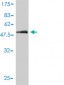 CD1A Antibody (monoclonal) (M01)