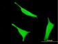 CD38 Antibody (monoclonal) (M02)