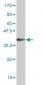 CD38 Antibody (monoclonal) (M02)